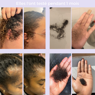 Batana Croissance Cheveux