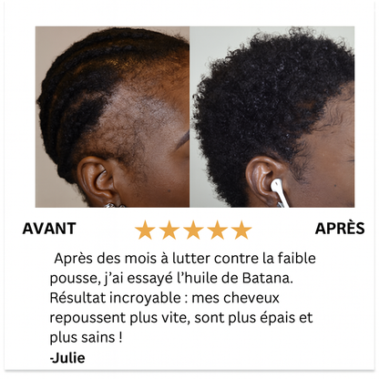 Batana Croissance Cheveux